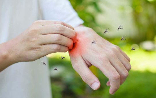 Proteggersi dalle fastidiose zanzare