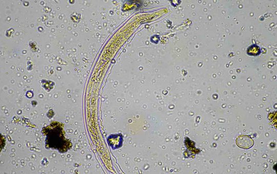 Microrganismo visto al microscopio