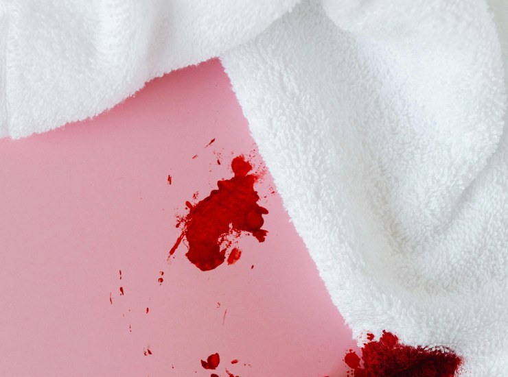 Macchie di sangue (pexels.com) - newsecologia.it